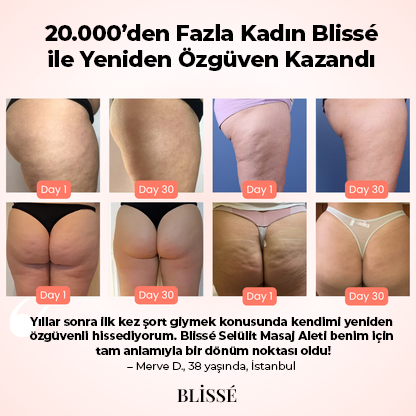 Blissé Akıllı Selülit Giderici Masaj Aleti