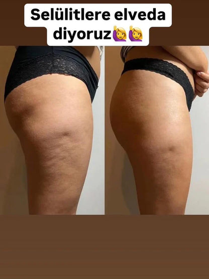 Blissé GlowLuxe Selülit Masaj Chazı